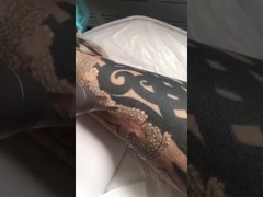 máy laser thứ hai pico để xóa hình xăm